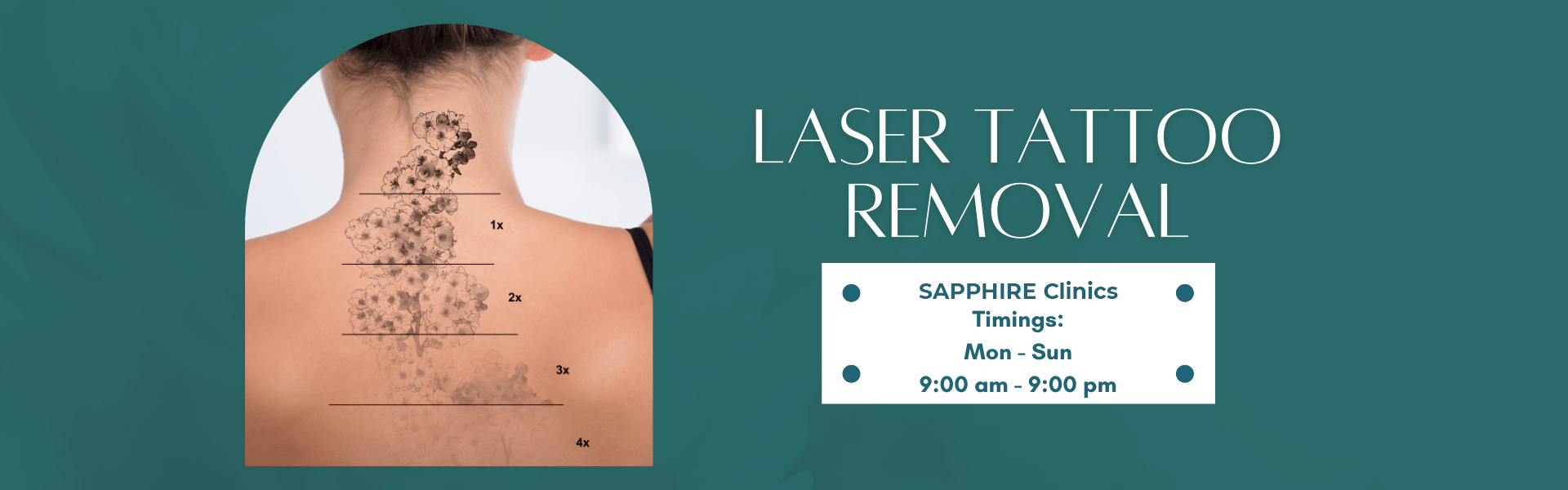 How Effective Is Laser Tattoo Removal? - Reno Sparks Medspa